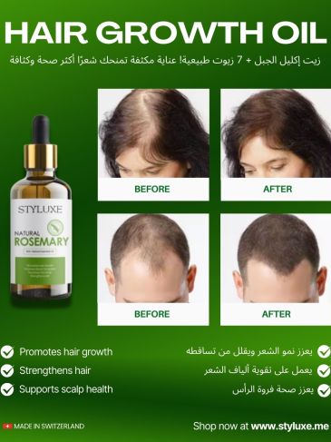 Natural Rosemary Scalp Hair Growth Natural