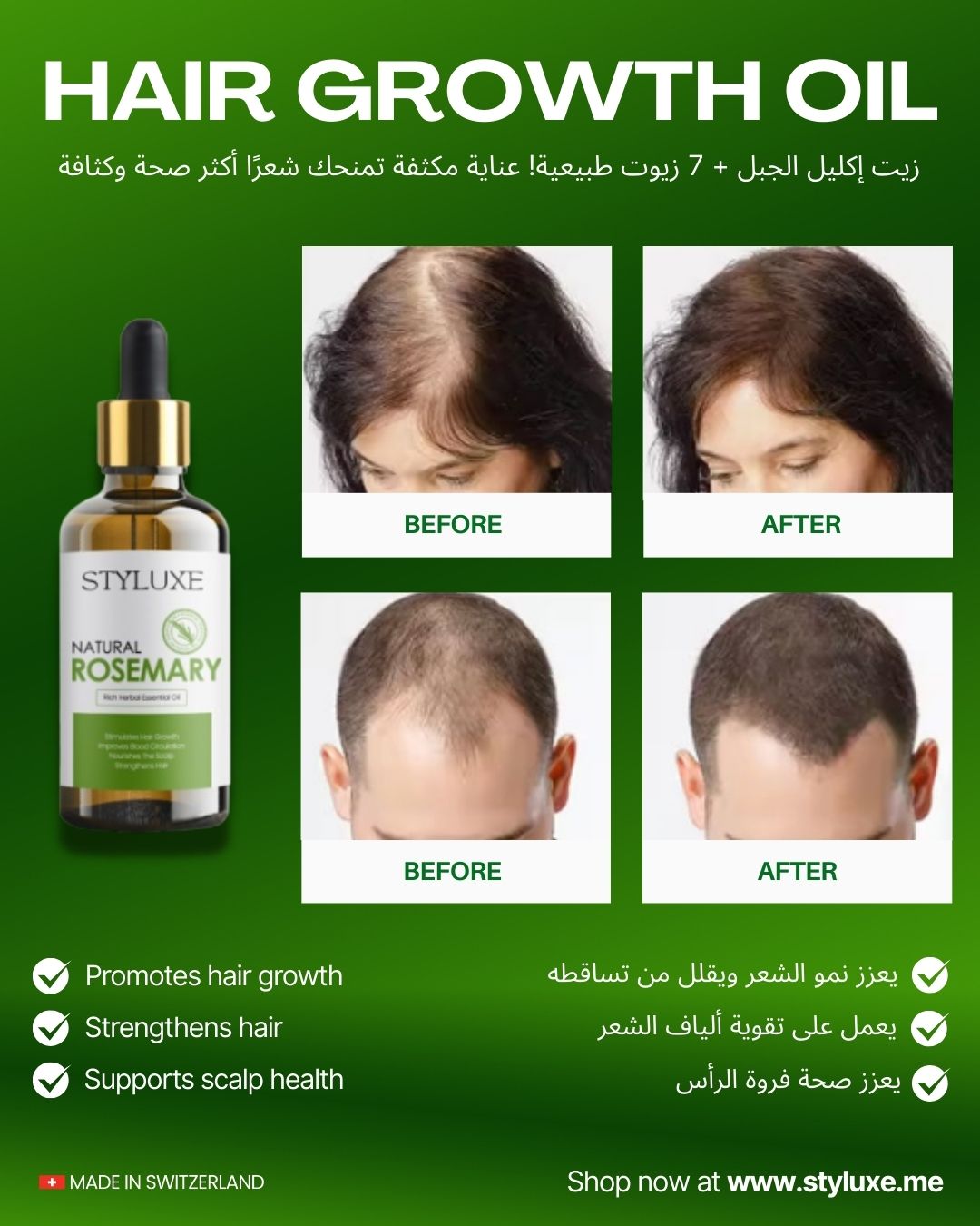 Natural Rosemary Scalp Hair Growth Natural