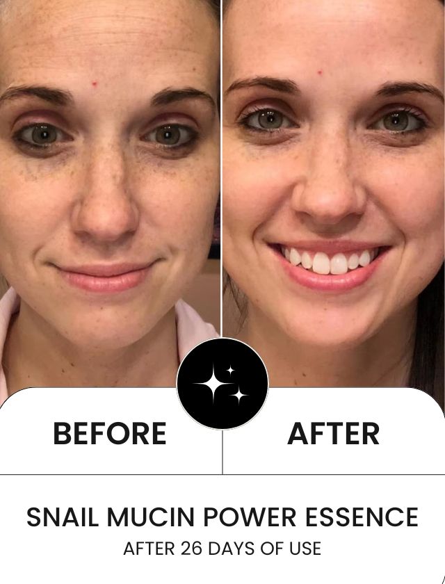 Advanced Snail Mucin Power Essence - Image 9