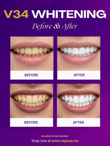 V34 Colour Corrector Teeth Whitening Duo - تركيبة مبتكرة لإزالة الاصفرار، تفتيح الأسنان فوراً، وحماية المينا