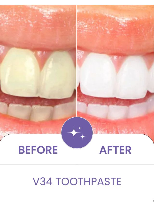 V34 Colour Corrector Teeth Whitening Duo - تركيبة مبتكرة لإزالة الاصفرار، تفتيح الأسنان فوراً، وحماية المينا - Image 10